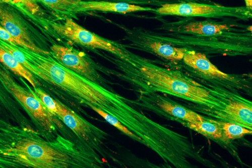 A picture of endometriosis stromal cell lines 