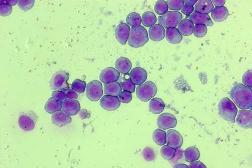 AML cell line