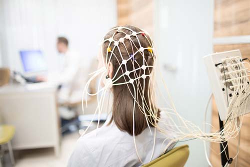 Picture of a woman with electrodes on the scalp.