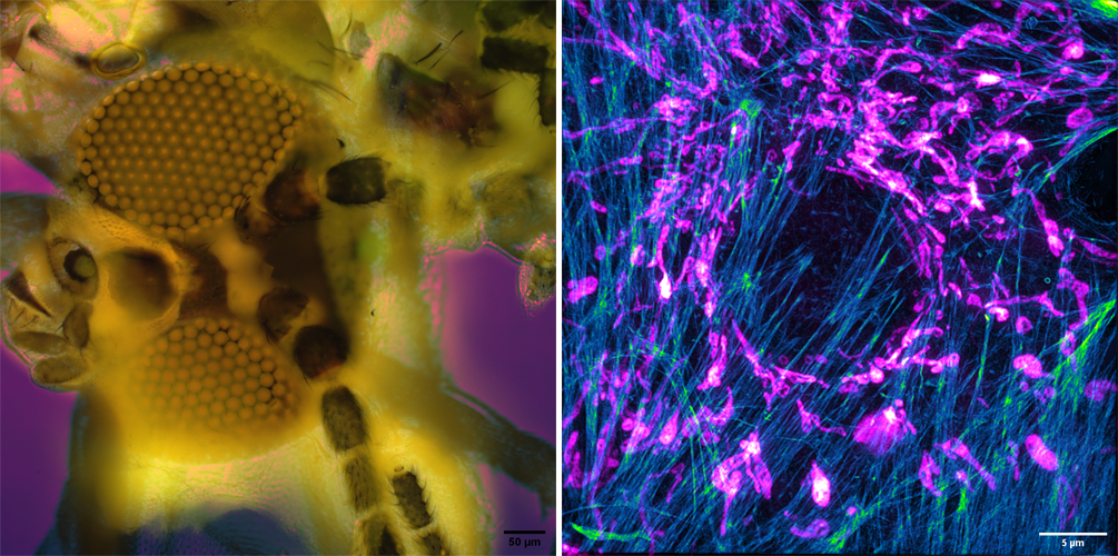 Two microscopy images.