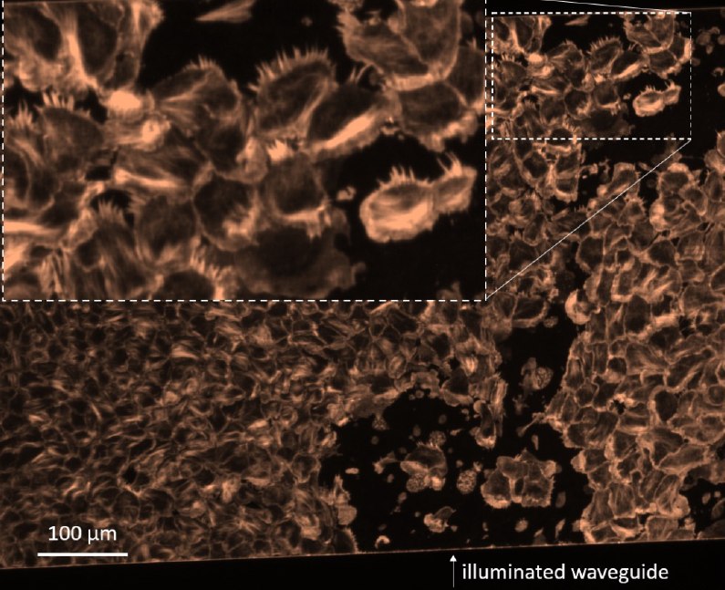 Fluorescence microscopy image.